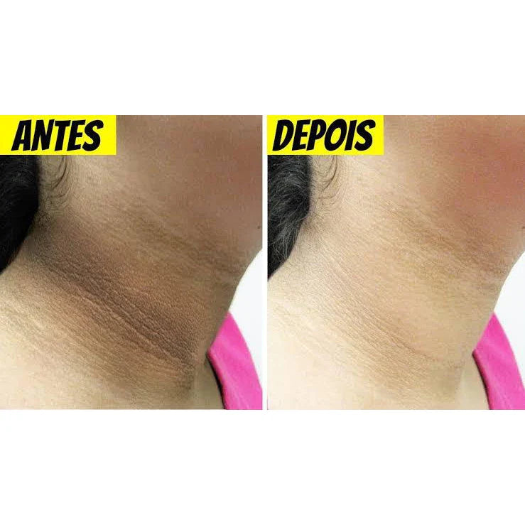 Kit Micosan Clareador de Manchas escuras Original