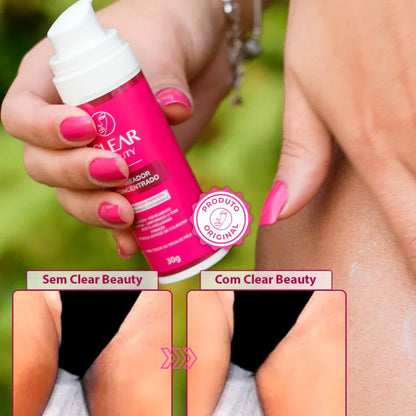 Clareador de virilha e axila Creme Clareador Partes Intimas - Clear Beauty