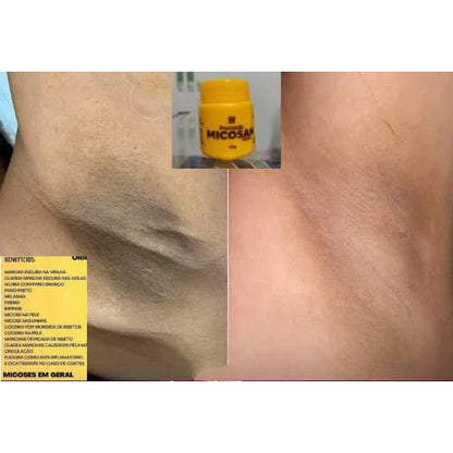 Kit Micosan Clareador de Manchas escuras Original