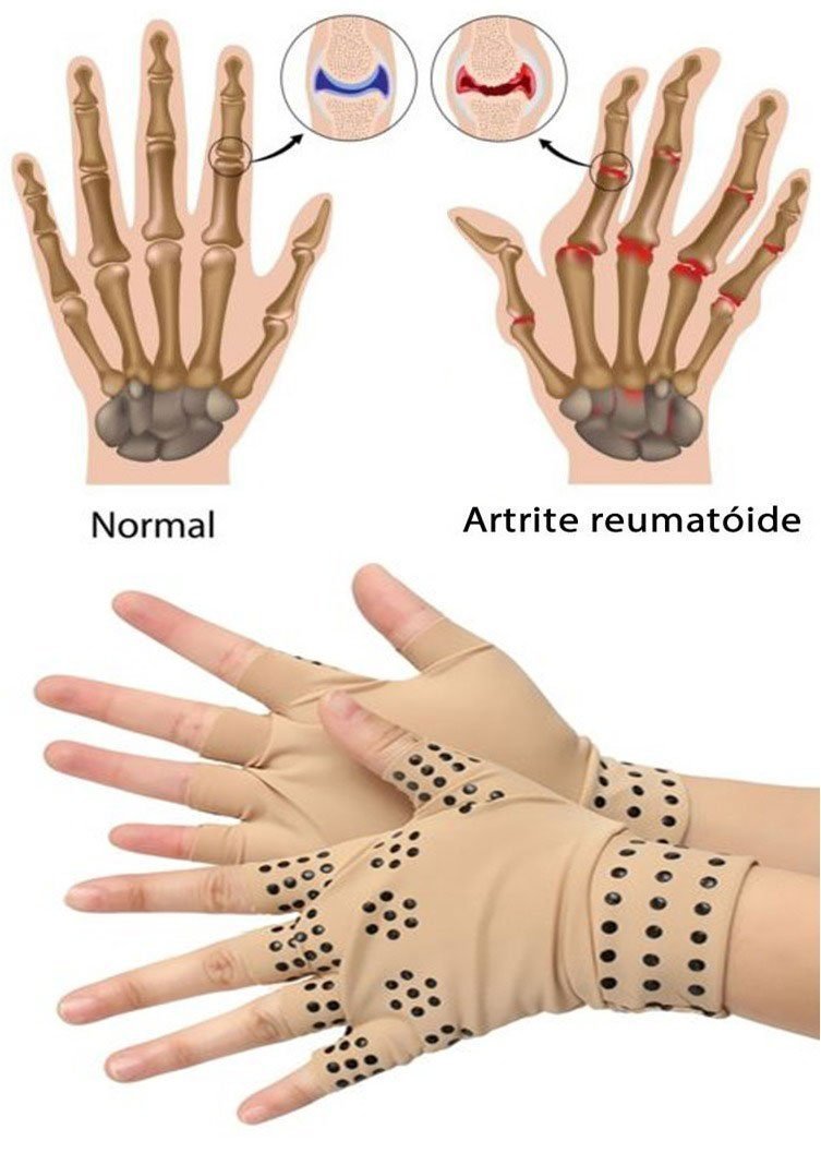 Luva Magnética - Alívio de Dores nas Mãos